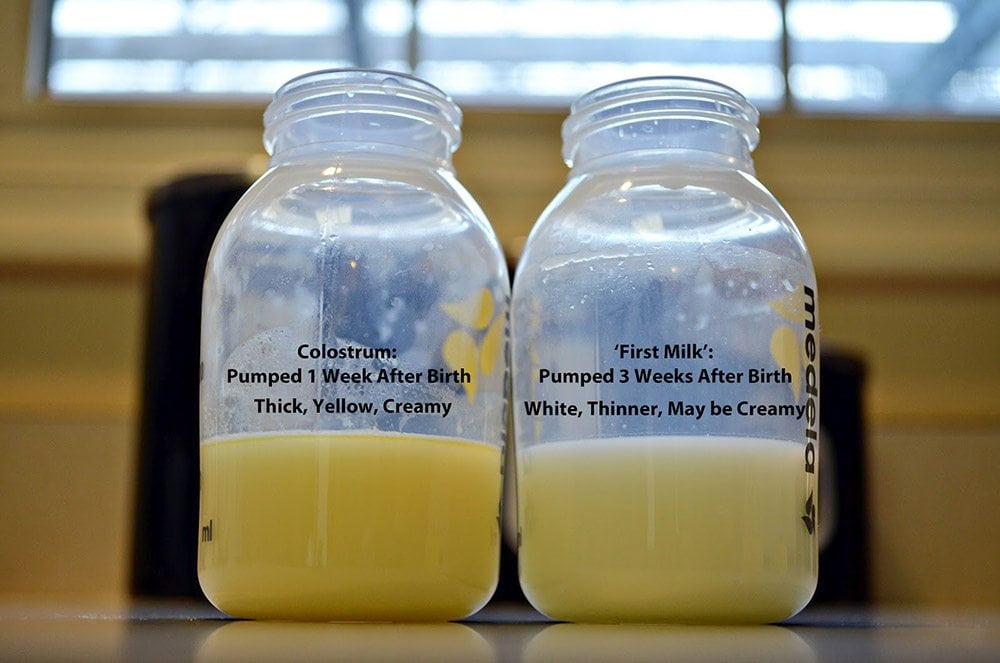 colostrum breast milk color